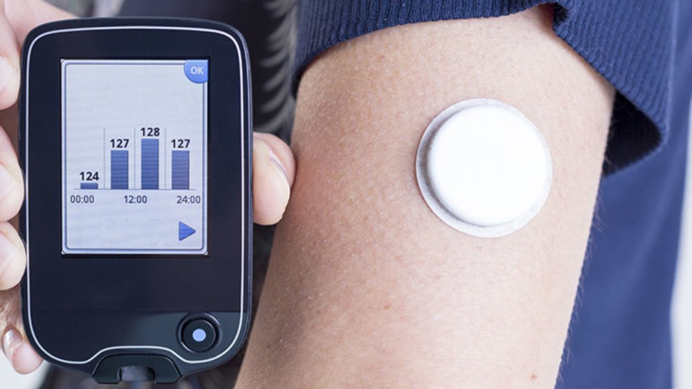 IOT internet of things smart watch salute